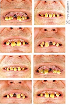 Dentier Dents Abimés accessoire